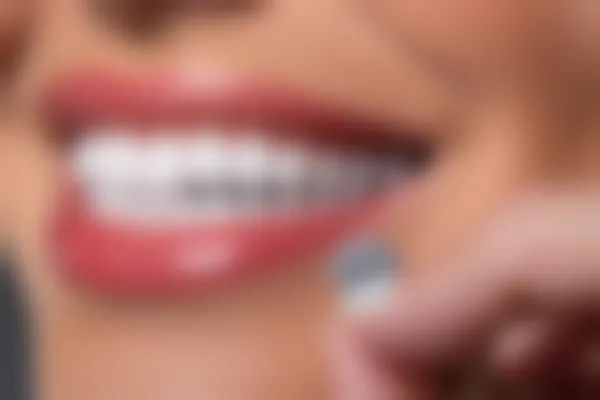 全瓷牙究竟是否指的是二氧化锆全瓷牙？深入解析全瓷牙的种类与特点
