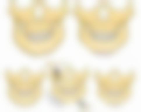 成都素美整形与润致2号玻尿酸相关其他类型的收费价格参考