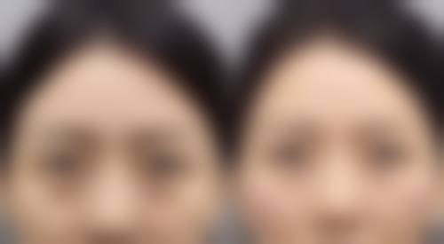 全国吸脂医院排名前十：上海华美、深圳艺星等上榜，分层吸脂、微雕技术助你安全变美！