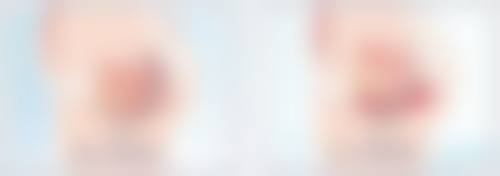 如何选择性价比高的半岛第五代黄金微针治疗