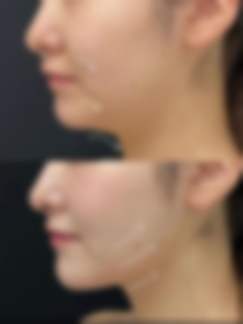 罗金超院长口碑评价及真人实例