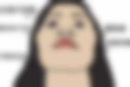 加速全切双眼皮消肿的有效方法