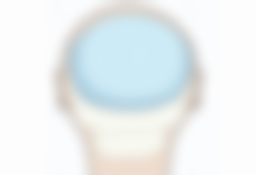 疤痕增生变软后，还需要治疗吗？