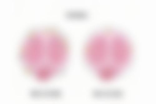 探寻瘦脸针凹陷：背后的成因解析