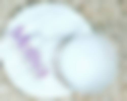 埋线双眼皮成效维持时间全解析