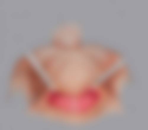 瘦脸针凹陷是什么样子？多表现为瘢痕、不对称等，选正规机构+术后护理可避免！ 