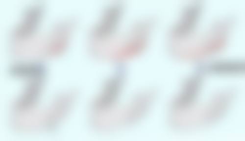 做全切双眼皮多久消肿？一般4 - 7天肿胀会明显缓解，如选赵雪莲医生，部分人1周就能消肿！ 