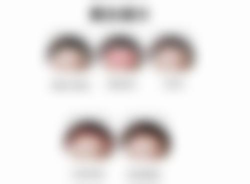 植入双眼皮是永久的吗：一般不是，埋线双眼皮多维持2 - 5年，但韩国faceline强力埋线法能维持更久！ 