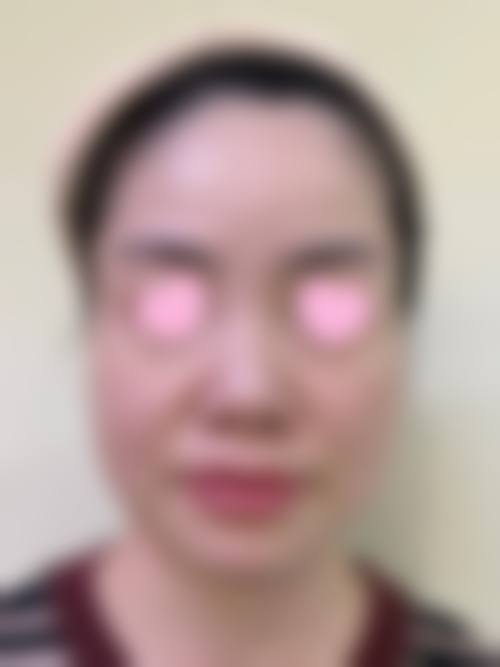 北京小美微针轻医美（北京合肥）详细的预约挂号方式及流程