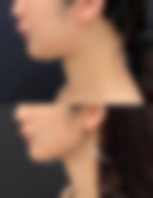 郑钟连医生预约挂号