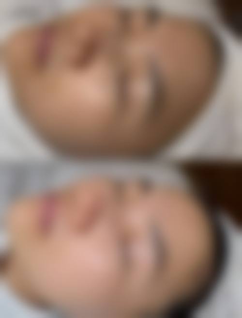 上海韩卓医疗属于什么档次？中韩医师坐诊技术优，92%满意度口碑佳！ 