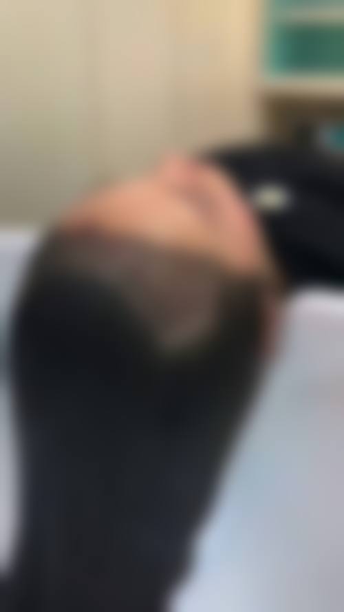 韩美植发：韩系精致植发体验