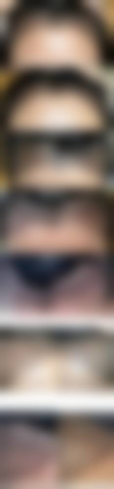 赣州植发医院排名哪家好？虔美小森林、韩美、华美植发技术优口碑好！ 