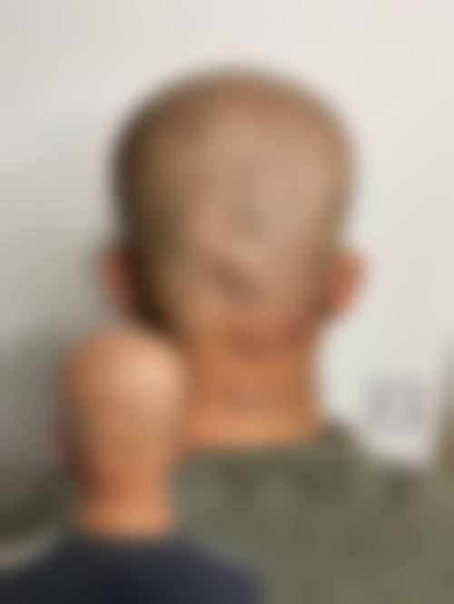 俪人植发：注重隐私的个性化之选