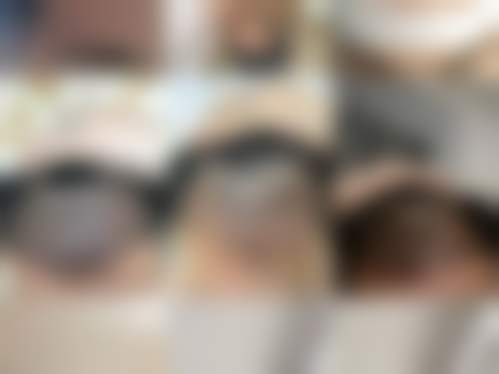 郑州顺美医疗整形医院真人口碑评价怎么样？