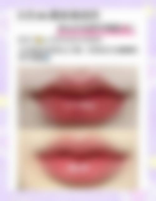 保定虞美人医疗整形医院特色项目及技术优势