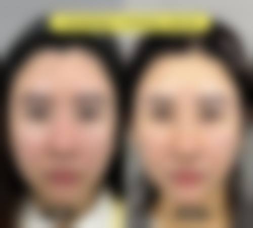 郑钟连医生擅长项目