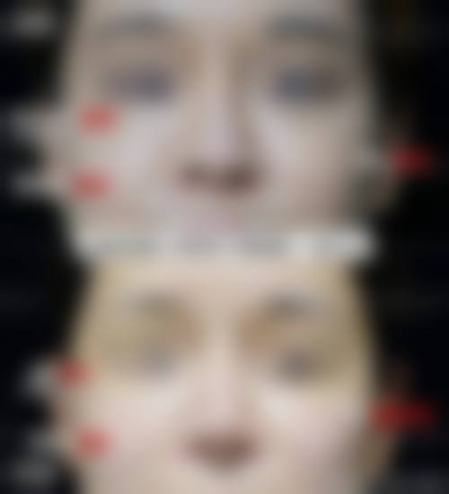 郑钟连医生口碑评价及真人实例