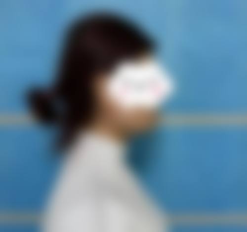 郑钟连医生技术优势