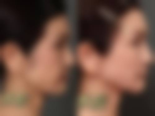 选择上海拉皮骨干医生的要点：擦亮眼睛选对人