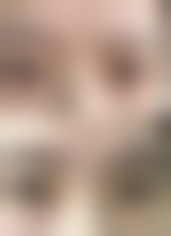 腹部抽脂会影响健康吗？选对技术风险可控，如5G光雕吸脂安心性高、恢复快！ 