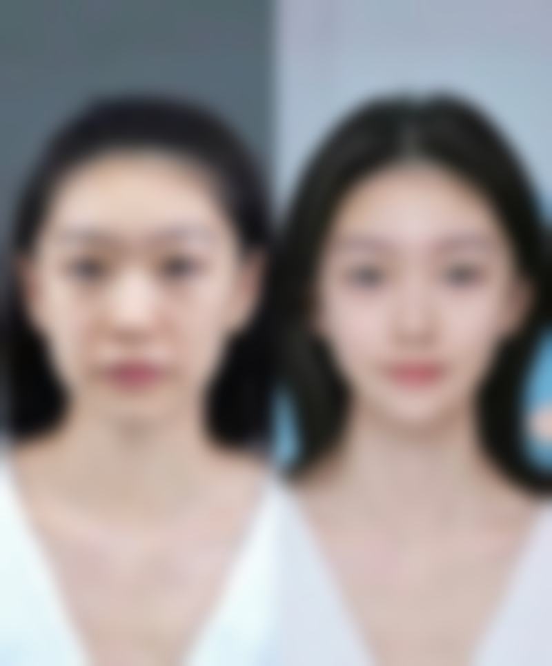 新兴县慢性病防治站详细的预约挂号方式及流程