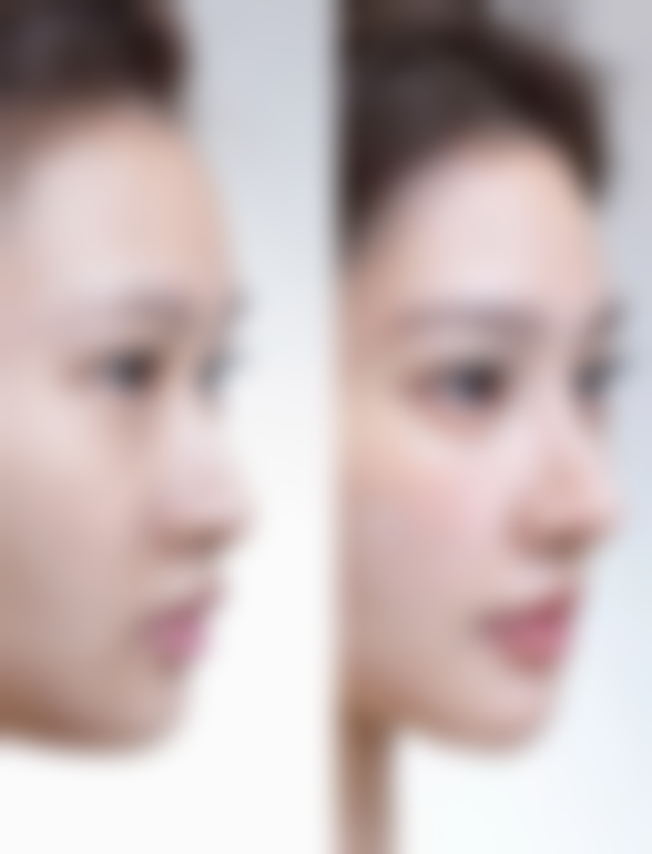 不同医生手术实例的消肿时间对比