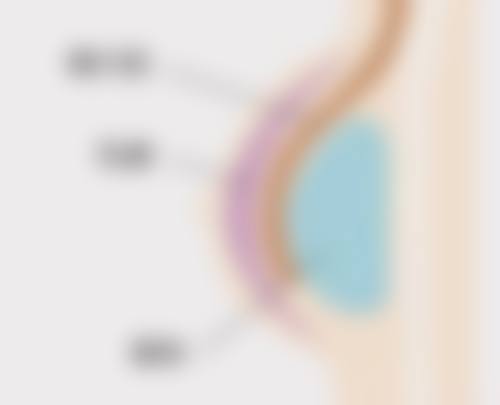 治疗价格大揭秘：合理预算去除疤痕疙瘩