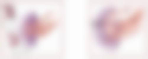 手术复杂程度左右隆鼻假体取出修复时长