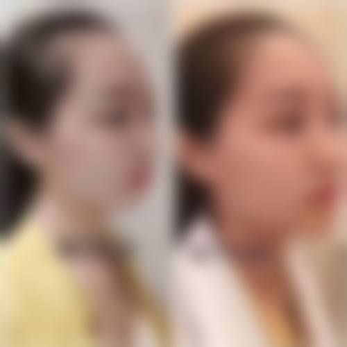 南充陈氏蓝天医院医学整形美容中 心特色项目及技术优势