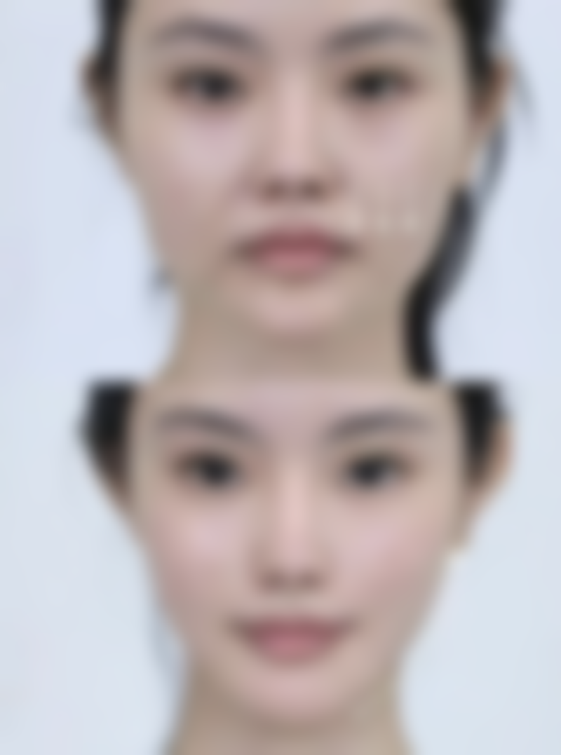 何贤清医生技术优势