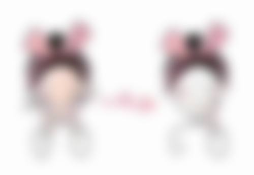 剖腹产增生疤痕：增生期后可修，修复时间有别