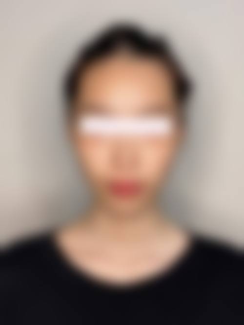 北京广济医院（整形科）详细的预约挂号方式及流程