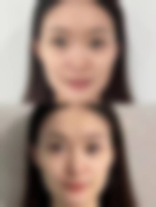 重庆红颜拜博医疗美容门诊部真人口碑评价怎么样？