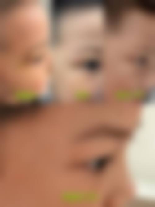 贵阳地区修复价格参考