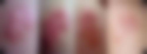 常见修复方法及原理