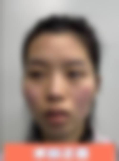 北京广济医院（整形科）真人口碑评价怎么样？