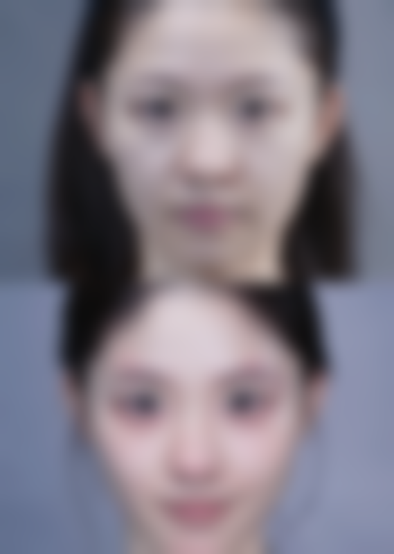 摩尔星松口腔亮点