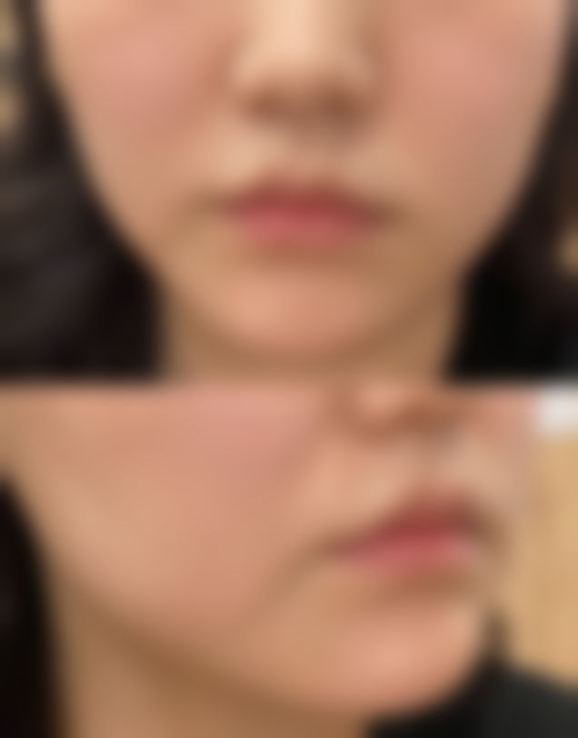 不同修复方法的优缺点