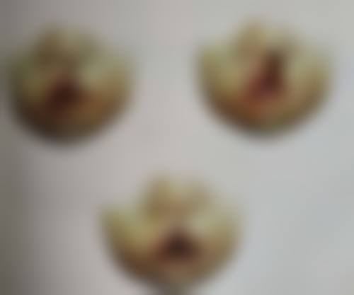 全切后做埋线可能面临的问题