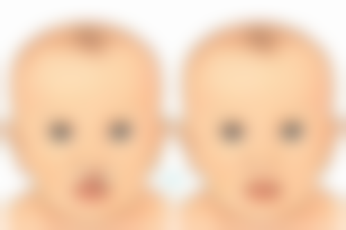 除皱针打多了好吗？频繁注射危害大，按正规疗程、剂量并选专业医生操作才靠谱！ 