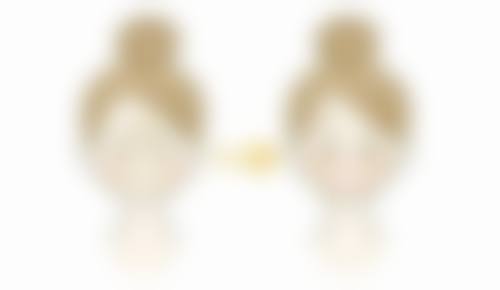 眼袋和眼睑是一个部位吗？不是！二者结构、功能不同，沈阳名流祛眼袋4000元起 