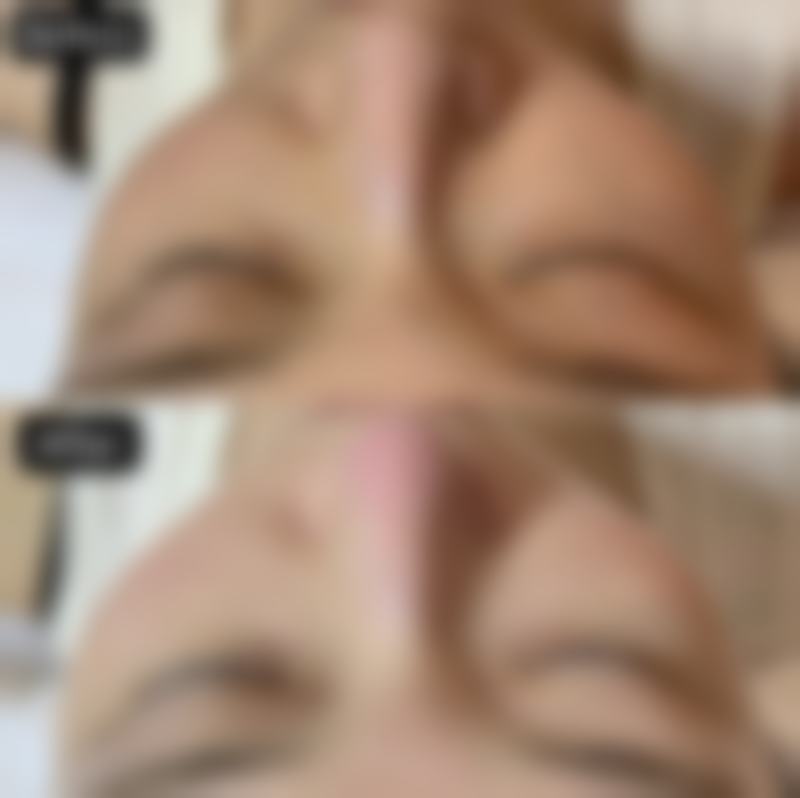 日常护理：促进疤痕愈合的基础工作