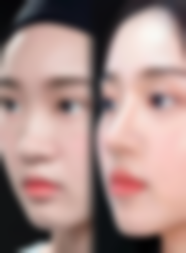 频繁注射除皱针的常见危害