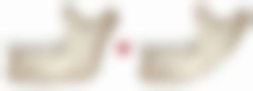 初真膨体：韩国新型材料，生物相容良好