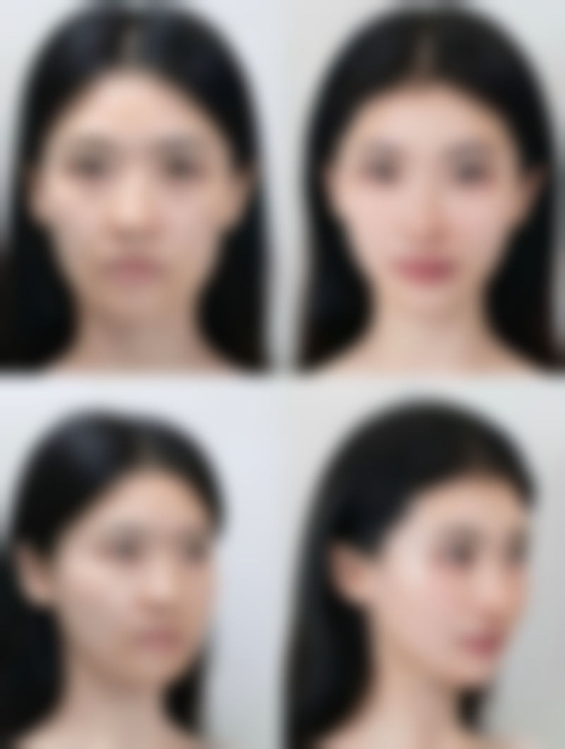 如何根据吸收时间做好术后护理