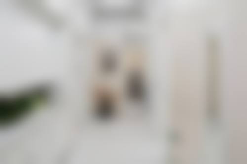 不同睡姿对双眼皮修复的影响