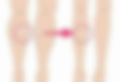 激光去眼袋的优势大盘点