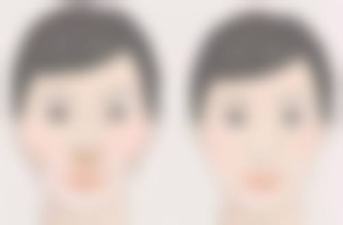 中度烫伤疤痕：医美治疗显成效