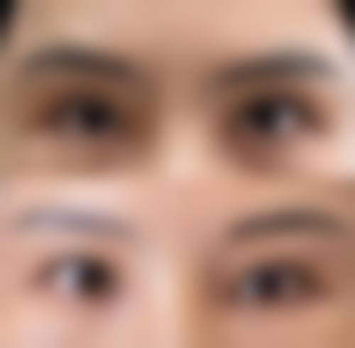 太原美娜医疗美容门诊部收费价格表/收费标准